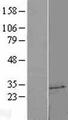 UCK2 Protein - Western validation with an anti-DDK antibody * L: Control HEK293 lysate R: Over-expression lysate