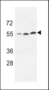 UCKL1 Antibody - Western blot of anti-URKL1 Pabin 293 cell line lysate (35 ug/lane). URKL1(arrow) was detected using the purified antibody.