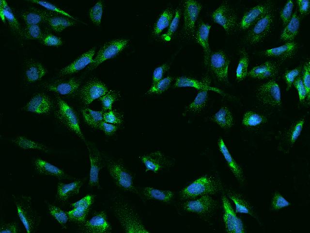 UCKL1 Antibody - Immunofluorescence staining of UCKL1 in U251MG cells. Cells were fixed with 4% PFA, permeabilzed with 0.1% Triton X-100 in PBS, blocked with 10% serum, and incubated with rabbit anti-Human UCKL1 polyclonal antibody (dilution ratio 1:200) at 4°C overnight. Then cells were stained with the Alexa Fluor 488-conjugated Goat Anti-rabbit IgG secondary antibody (green) and counterstained with DAPI (blue). Positive staining was localized to Cytoplasm.