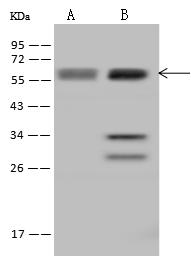 UCKL1 Antibody - Anti-UCKL1 rabbit polyclonal antibody at 1:500 dilution. Lane A: 293T Whole Cell Lysate. Lane B: HeLa Whole Cell Lysate. Lysates/proteins at 30 ug per lane. Secondary: Goat Anti-Rabbit IgG (H+L)/HRP at 1/10000 dilution. Developed using the ECL technique. Performed under reducing conditions. Predicted band size: 61 kDa. Observed band size: 61 kDa. (We are unsure as to the identity of these extra bands.)