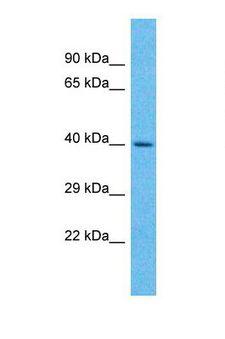 UCKL1 Antibody - Western blot of Human 721_B. UCKL1 antibody dilution 1.0 ug/ml.  This image was taken for the unconjugated form of this product. Other forms have not been tested.