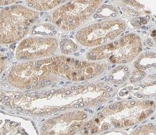 UCN / Urocortin Antibody - 1:100 staining human kidney tissue by IHC-P. The tissue was formaldehyde fixed and a heat mediated antigen retrieval step in citrate buffer was performed. The tissue was then blocked and incubated with the antibody for 1.5 hours at 22°C. An HRP conjugated goat anti-rabbit antibody was used as the secondary.
