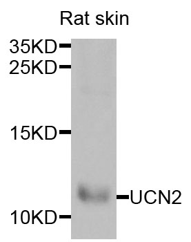 UCN2 / SRP Antibody - Western blot analysis of extracts of rat skin cells.