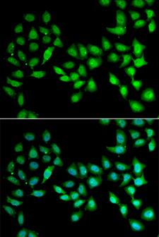 UCN2 / SRP Antibody - Immunofluorescence analysis of U2OS cells.