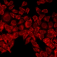 UCN2 / SRP Antibody