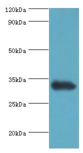 UCP1 / UCP-1 Antibody - Western blot. All lanes: Mitochondrial brown fat uncoupling protein 1 antibody at 2 ug/ml+mouse kidney tissue. Secondary antibody: Goat polyclonal to rabbit at 1:10000 dilution. Predicted band size: 33 kDa. Observed band size: 33 kDa Immunohistochemistry.