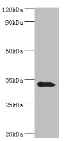 UCP1 / UCP-1 Antibody - Western blot All lanes: Mitochondrial brown fat uncoupling protein 1 antibody at 2µg/ml + Mouse kidney tissue Secondary Goat polyclonal to rabbit IgG at 1/10000 dilution Predicted band size: 33 kDa Observed band size: 33 kDa