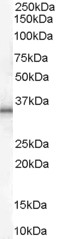 UCP1 / UCP-1 Antibody - Antibody (1 ug/ml) staining of Human Adipose lysate (35 ug protein in RIPA buffer). Primary incubation was 1 hour. Detected by chemiluminescence.