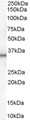 UCP1 / UCP-1 Antibody - Antibody (1 ug/ml) staining of Human Adipose lysate (35 ug protein in RIPA buffer). Primary incubation was 1 hour. Detected by chemiluminescence.