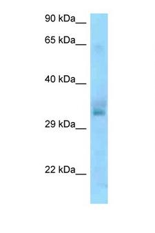UCP1 / UCP-1 Antibody - UCP1 antibody Western blot of Jurkat Cell lysate. Antibody concentration 1 ug/ml.  This image was taken for the unconjugated form of this product. Other forms have not been tested.