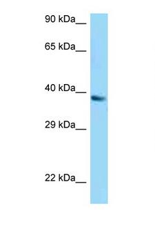 UCP1 / UCP-1 Antibody - UCP1 antibody Western blot of A549 Cell lysate. Antibody concentration 1 ug/ml.  This image was taken for the unconjugated form of this product. Other forms have not been tested.