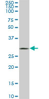 UCP1 / UCP-1 Antibody - UCP1 monoclonal antibody (M03), clone 4B7. Western blot of UCP1 expression in NIH/3T3.