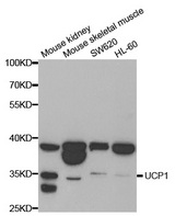 UCP1 / UCP-1 Antibody - Western blot analysis of extracts of various cell lines, using UCP1 antibody.
