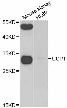 UCP1 / UCP-1 Antibody - Western blot analysis of extracts of various cell lines.