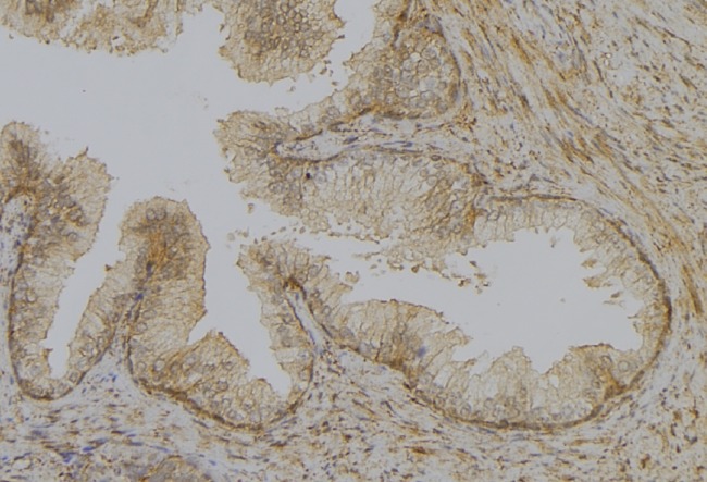UCP1 / UCP-1 Antibody - 1:100 staining mouse colon tissue by IHC-P. The sample was formaldehyde fixed and a heat mediated antigen retrieval step in citrate buffer was performed. The sample was then blocked and incubated with the antibody for 1.5 hours at 22°C. An HRP conjugated goat anti-rabbit antibody was used as the secondary.
