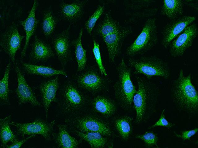 UCP1 / UCP-1 Antibody - Immunofluorescence staining of UCP2 in Hela cells. Cells were fixed with 4% PFA, permeabilzed with 0.1% Triton X-100 in PBS, blocked with 10% serum, and incubated with rabbit anti-Human UCP2 polyclonal antibody (dilution ratio 1:200) at 4°C overnight. Then cells were stained with the Alexa Fluor 488-conjugated Goat Anti-rabbit IgG secondary antibody (green) and counterstained with DAPI (blue). Positive staining was localized to Cytoplasm.