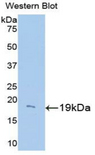 UCP2 Antibody - Western blot of recombinant UCP2.  This image was taken for the unconjugated form of this product. Other forms have not been tested.