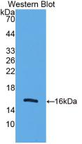 UCP2 Antibody - Western Blot; Sample: Recombinant UCP2, Human.