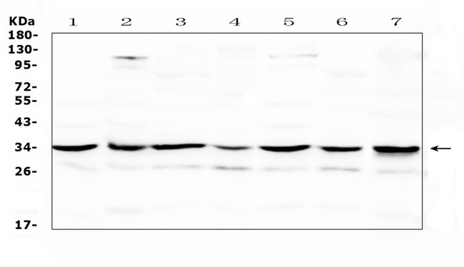 UCP2 Antibody - Western blot analysis of UCP2 using anti-UCP2 antibody. Electrophoresis was performed on a 5-20% SDS-PAGE gel at 70V (Stacking gel) / 90V (Resolving gel) for 2-3 hours. The sample well of each lane was loaded with 50ug of sample under reducing conditions. Lane 1: rat spleen tissue lysate,Lane 2: rat cardiac muscle tissue lysate,Lane 3: rat brain tissue lysate,Lane 4: mouse spleen tissue lysate,Lane 5: mouse cardiac muscle tissue lysate,Lane 6: mouse brain tissue lysate,Lane 7: human Hela whole cell lysate. After Electrophoresis, proteins were transferred to a Nitrocellulose membrane at 150mA for 50-90 minutes. Blocked the membrane with 5% Non-fat Milk/ TBS for 1.5 hour at RT. The membrane was incubated with rabbit anti-UCP2 antigen affinity purified polyclonal antibody at 0.5 µg/mL overnight at 4°C, then washed with TBS-0.1% Tween 3 times with 5 minutes each and probed with a goat anti-rabbit IgG-HRP secondary antibody at a dilution of 1:10000 for 1.5 hour at RT. The signal is developed using an Enhanced Chemiluminescent detection (ECL) kit with Tanon 5200 system. A specific band was detected for UCP2 at approximately 33KD. The expected band size for UCP2 is at 33KD.