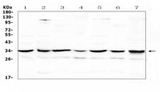 UCP2 Antibody - Western blot analysis of UCP2 using anti-UCP2 antibody. Electrophoresis was performed on a 5-20% SDS-PAGE gel at 70V (Stacking gel) / 90V (Resolving gel) for 2-3 hours. The sample well of each lane was loaded with 50ug of sample under reducing conditions. Lane 1: rat spleen tissue lysate,Lane 2: rat cardiac muscle tissue lysate,Lane 3: rat brain tissue lysate,Lane 4: mouse spleen tissue lysate,Lane 5: mouse cardiac muscle tissue lysate,Lane 6: mouse brain tissue lysate,Lane 7: human Hela whole cell lysate. After Electrophoresis, proteins were transferred to a Nitrocellulose membrane at 150mA for 50-90 minutes. Blocked the membrane with 5% Non-fat Milk/ TBS for 1.5 hour at RT. The membrane was incubated with rabbit anti-UCP2 antigen affinity purified polyclonal antibody at 0.5 µg/mL overnight at 4°C, then washed with TBS-0.1% Tween 3 times with 5 minutes each and probed with a goat anti-rabbit IgG-HRP secondary antibody at a dilution of 1:10000 for 1.5 hour at RT. The signal is developed using an Enhanced Chemiluminescent detection (ECL) kit with Tanon 5200 system. A specific band was detected for UCP2 at approximately 33KD. The expected band size for UCP2 is at 33KD.