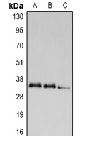 UCP2 Antibody - Western blot analysis of UCP2 expression in HEK293T (A), Raw264.7 (B), PC12 (C) whole cell lysates.
