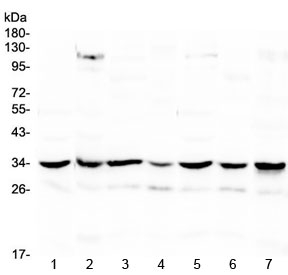 UCP2 Antibody - Western blot testing of 1) rat spleen, 2) rat heart, 3) rat brain, 4) mouse spleen, 5) mouse heart, 6) mouse brain and 7) human HeLa lysate with UCP2 antibody at 0.5ug/ml. Predicted molecular weight ~34 kDa.