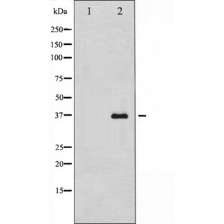UCP2 Antibody - Western blot analysis UCP2 using HuvEc whole cells lysates