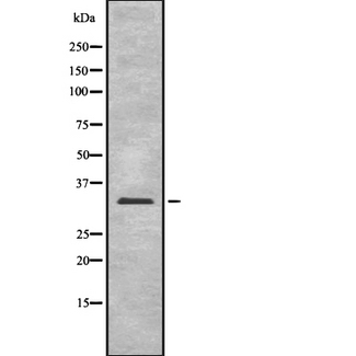 UCP2 Antibody - Western blot analysis of UCP2 antibody expression in rat brain tissue lysates.