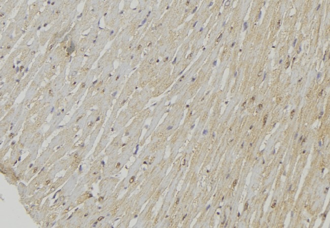 UCP2 Antibody - 1:100 staining mouse muscle tissue by IHC-P. The sample was formaldehyde fixed and a heat mediated antigen retrieval step in citrate buffer was performed. The sample was then blocked and incubated with the antibody for 1.5 hours at 22°C. An HRP conjugated goat anti-rabbit antibody was used as the secondary.