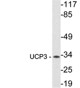 UCP3 Antibody - Western blot analysis of lysate from Jurkat cells, using UCP3 antibody.