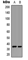 UCP3 Antibody - Western blot analysis of UCP3 expression in L929 (A); rat kidney (B) whole cell lysates.