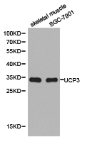 UCP3 Antibody - Western blot of extracts of skeletal muscle cell and SGC-7901 cell line, using UCP3 antibody.