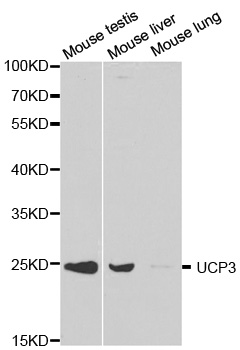 UCP3 Antibody - Western blot analysis of extracts of various cell lines, using UCP3 antibody at 1:1000 dilution. The secondary antibody used was an HRP Goat Anti-Rabbit IgG (H+L) at 1:10000 dilution. Lysates were loaded 25ug per lane and 3% nonfat dry milk in TBST was used for blocking.