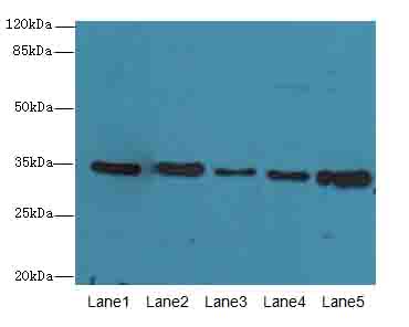 UCP3 Antibody - Western blot. All lanes: UCP3 antibody at 0.9 ug/ml. Lane 1: Jurkat whole cell lysate. Lane 2: SH-SY5Y whole cell lysate. Lane 3: U251 whole cell lysate. Lane 4: A549 whole cell lysate. Lane 5: HeLa whole cell lysate. Secondary Goat polyclonal to Rabbit IgG at 1:10000 dilution. Predicted band size: 34 kDa. Observed band size: 34 kDa.