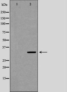 UCP3 Antibody - Western blot analysis of extracts of skeletal muscle using UCP3 antibody. The lane on the left is treated with the antigen-specific peptide.