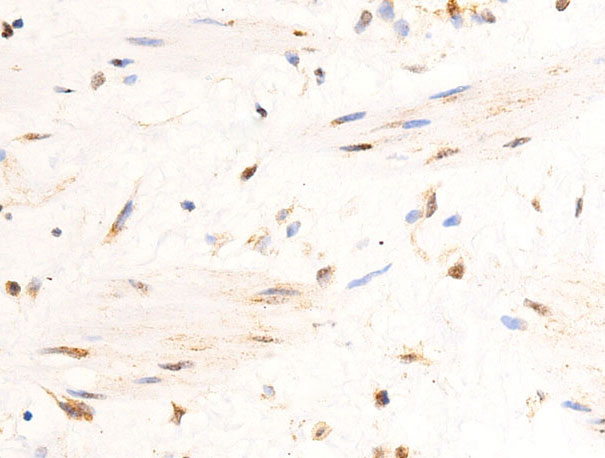 UCP3 Antibody - 1:200 staining human heart tissue by IHC-P. The tissue was formaldehyde fixed and a heat mediated antigen retrieval step in citrate buffer was performed. The tissue was then blocked and incubated with the antibody for 1.5 hours at 22°C. An HRP conjugated goat anti-rabbit antibody was used as the secondary.