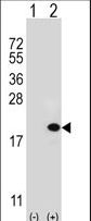 UEV1 / UEV1A Antibody - Western blot of UBE2V1 (arrow) using rabbit polyclonal UBE2V1 Antibody (M151). 293 cell lysates (2 ug/lane) either nontransfected (Lane 1) or transiently transfected (Lane 2) with the UBE2V1 gene.