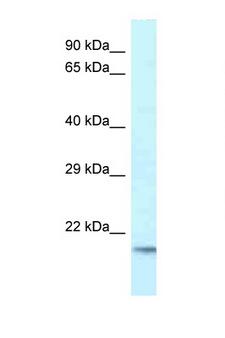 UEV1 / UEV1A Antibody - UBE2V1 antibody Western blot of Fetal Brain lysate. Antibody concentration 1 ug/ml.  This image was taken for the unconjugated form of this product. Other forms have not been tested.
