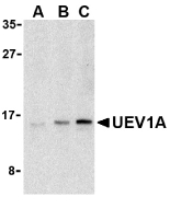 UEV1 / UEV1A Antibody - Western blot of UEV1A in Jurkat cell lysates with UEV1A antibody at (A) 1, (B) 2, and (C) 4 ug/ml.