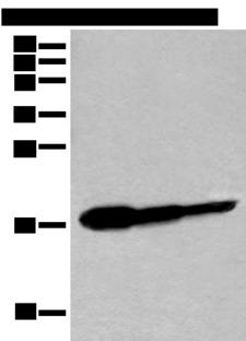 UEV1 / UEV1A Antibody - Western blot analysis of Human fetal brain tissue HT-29 cell and Jurkat cell lysates  using UBE2V1 Polyclonal Antibody at dilution of 1:250