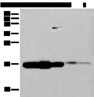 UEV1 / UEV1A Antibody - Western blot analysis of 293T cell Mouse spleen tissue and Human spleen tissue lysates  using UBE2V1 Polyclonal Antibody at dilution of 1:400