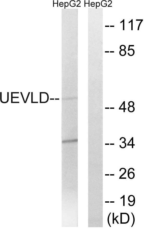 UEVLD Antibody - Western blot analysis of lysates from HepG2 cells, using UEVLD Antibody. The lane on the right is blocked with the synthesized peptide.