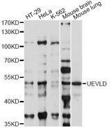 UEVLD Antibody - Western blot analysis of extracts of various cell lines, using UEVLD antibody at 1:1000 dilution. The secondary antibody used was an HRP Goat Anti-Rabbit IgG (H+L) at 1:10000 dilution. Lysates were loaded 25ug per lane and 3% nonfat dry milk in TBST was used for blocking. An ECL Kit was used for detection and the exposure time was 60s.