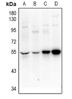 UEVLD Antibody - Western blot analysis of UEVLD expression in Hela (A), Jurkat (B), H9C2 (C), AML12 (D) whole cell lysates.