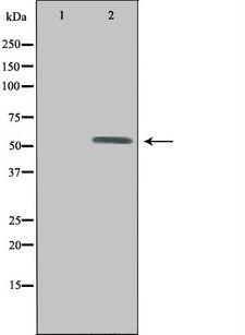 UEVLD Antibody - Western blot analysis of extracts of HepG2 cells using UEVLD antibody.