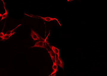 UEVLD Antibody - Staining HepG2 cells by IF/ICC. The samples were fixed with PFA and permeabilized in 0.1% Triton X-100, then blocked in 10% serum for 45 min at 25°C. The primary antibody was diluted at 1:200 and incubated with the sample for 1 hour at 37°C. An Alexa Fluor 594 conjugated goat anti-rabbit IgG (H+L) Ab, diluted at 1/600, was used as the secondary antibody.