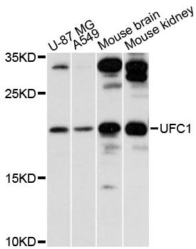 UFC1 Antibody - Western blot analysis of extracts of various cell lines, using UFC1 antibody at 1:3000 dilution. The secondary antibody used was an HRP Goat Anti-Rabbit IgG (H+L) at 1:10000 dilution. Lysates were loaded 25ug per lane and 3% nonfat dry milk in TBST was used for blocking. An ECL Kit was used for detection and the exposure time was 30s.