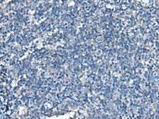UFC1 Antibody - Immunohistochemistry of paraffin-embedded Human tonsil tissue  using UFC1 Polyclonal Antibody at dilution of 1:50(×200)