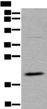UFC1 Antibody - Western blot analysis of RAW264.7 cell lysate  using UFC1 Polyclonal Antibody at dilution of 1:500