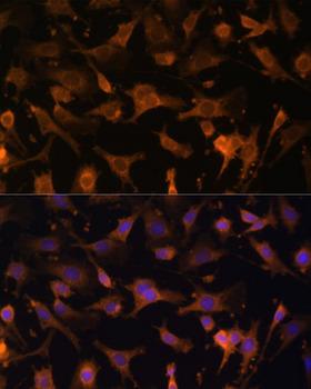 UFC1 Antibody - Immunofluorescence analysis of C6 cells using UFC1 Polyclonal Antibody at dilution of 1:100 (40x lens).Blue: DAPI for nuclear staining.